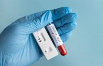 hand-with-protective-gloves-holding-blood-sample-covid-test_23-2148958351