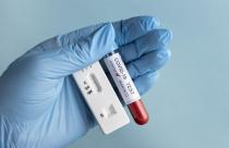 hand-with-protective-gloves-holding-a-blood-sample-for-covid-test