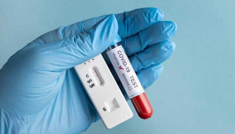 hand-with-protective-gloves-holding-blood-sample-covid-test_23-2148958351