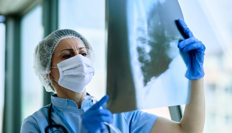 Female doctor examining patient's chest X-ray at the hospital.