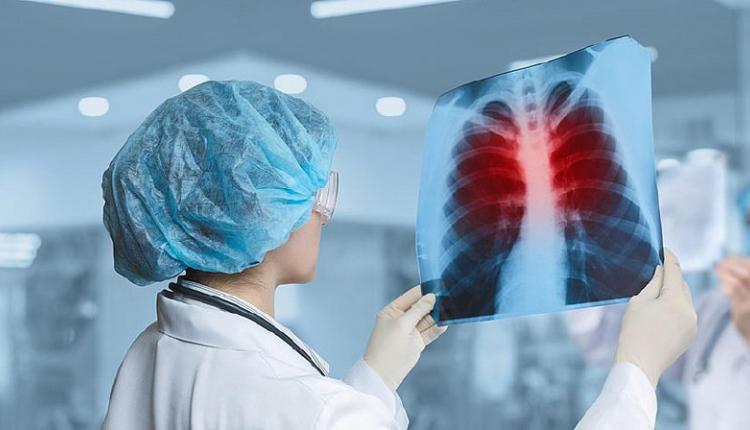 Эпидемическая ситуация по туберкулезу в Саратовской области остается стабильной